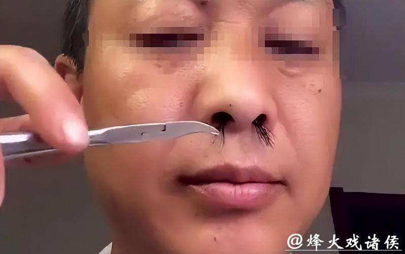 鼻毛“窜”出来的男人, 有何不同? 鼻毛变白暗示什么? 一文说清楚