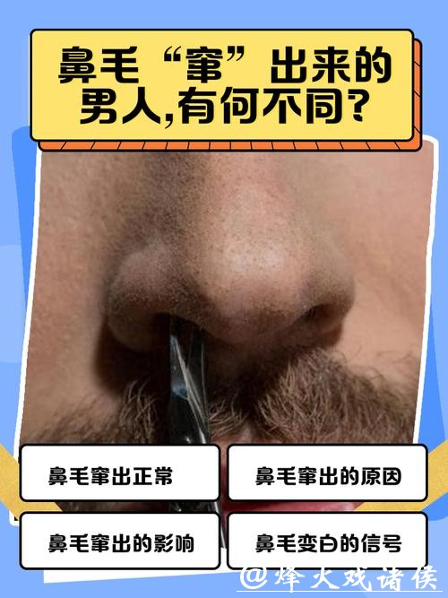 鼻毛“窜”出来的男人, 有何不同? 鼻毛变白暗示什么? 一文说清楚